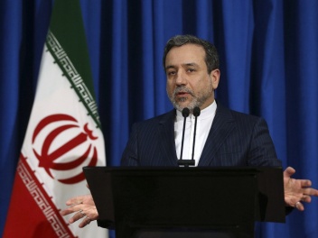 Ներկայի և քարի դարի միջև կա մի ակնառու տարբեր...